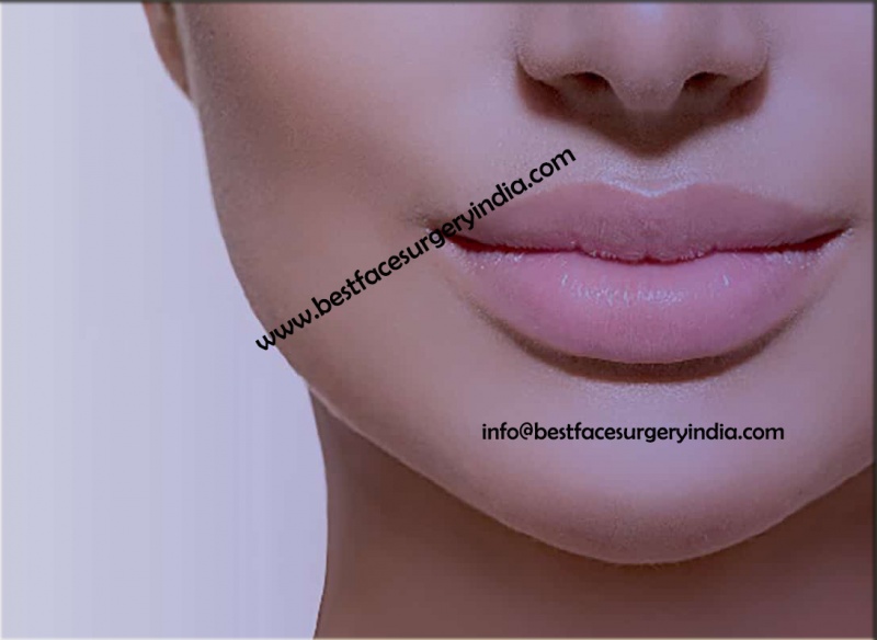 Lip Reduction – Do you have large lips?