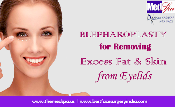 Blepharoplasty for Removing Excess Fat & Skin from Eyelids