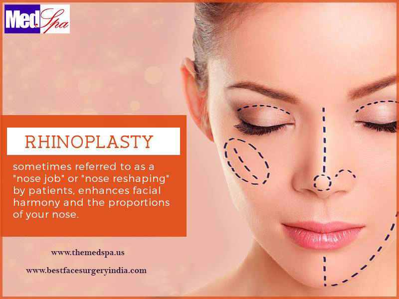 nose job rhinoplasty surgery in Delhi