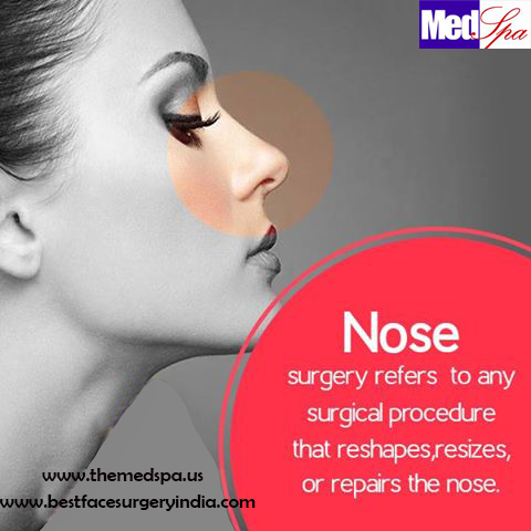 nose surgery in Delhi